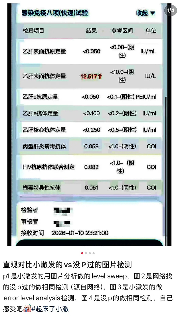超帅网红患梅毒事件详细经过梳理:直播露出艾滋病药+辟谣体检图,p图被扒(组图) - 13