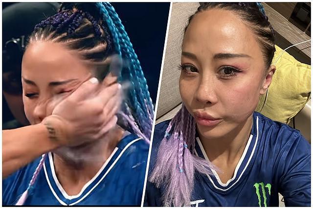 中国女选手参加“世界扇耳光大赛”被对手扇成“猪头”(组图) - 1