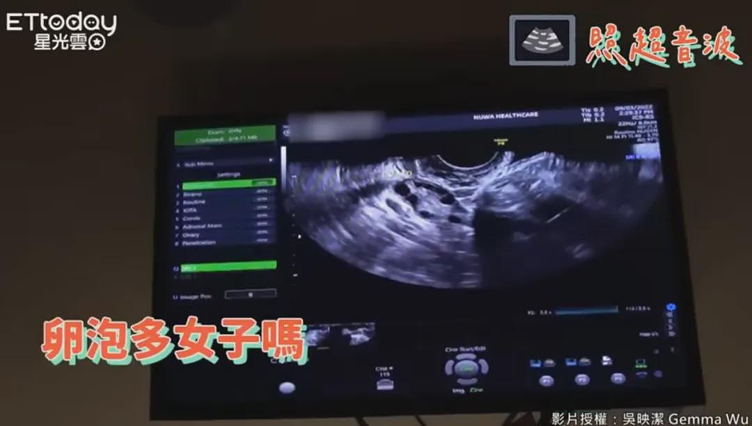 未婚生育,娃都一岁了?36岁女顶流突然晒照,被质疑“去父留子”,网友:现在都流行这么当妈吗?(组图) - 26