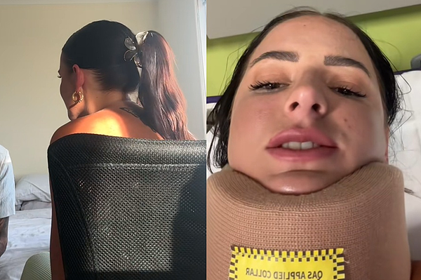 比车祸还恐怖!22岁女子“鲨鱼夹”重击头颈送医!网友惊吓:不敢用了(视频/图) - 1
