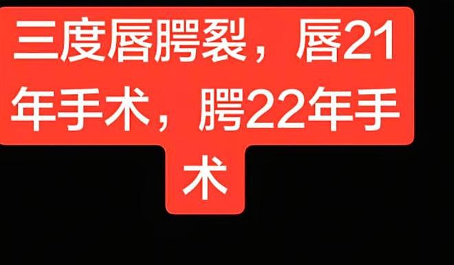 多位唇腭裂患儿家庭发声感谢李亚鹏,网友喊话王菲,希望她伸援手(组图) - 14