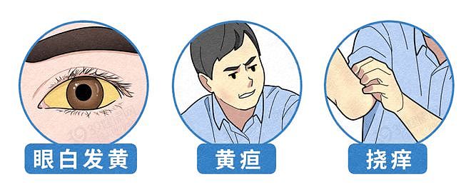 【健康】全球近一半肝癌在中国,提醒:家中的这4种食物,尽早撤下餐桌(组图) - 6