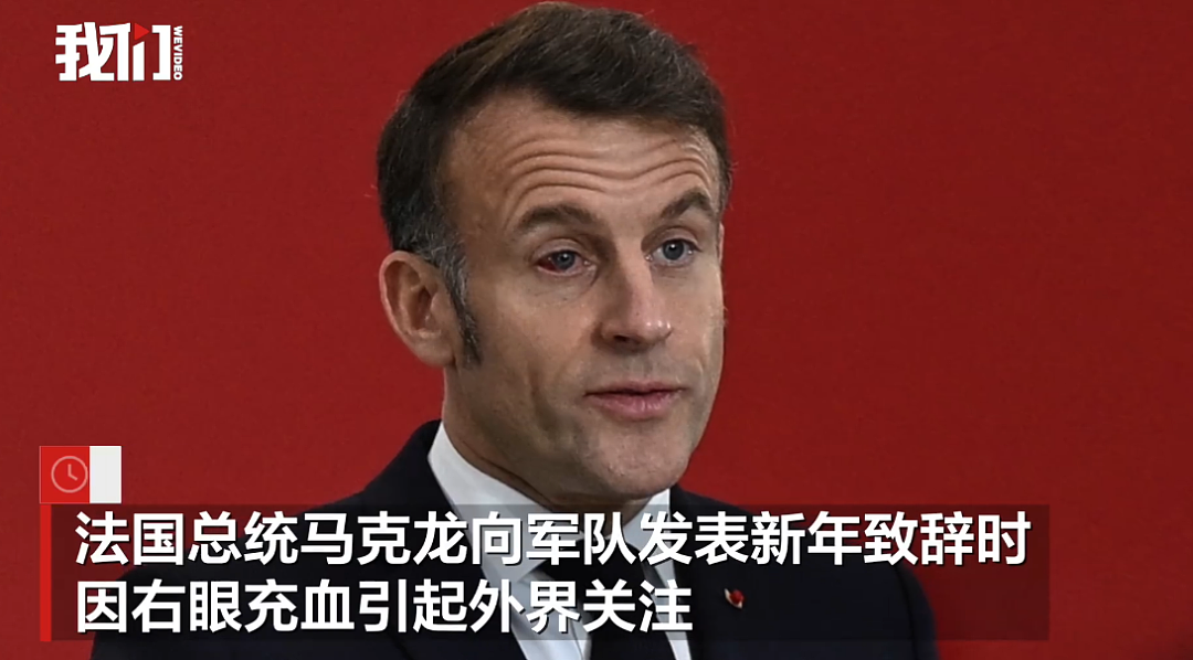 马克龙右眼充血再惹“家暴”疑云，爱丽舍宫回应：意外情况，此前被夫人当众“打脸”（组图） - 2