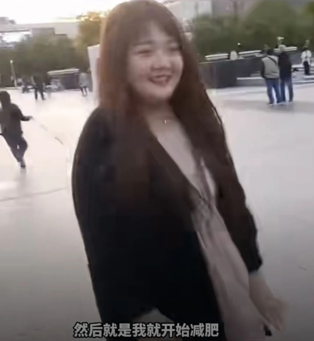 面部出现此种变化可能是恶疾前兆,24岁清秀女子样貌突变,“不爱喝奶茶也没遗传史“(组图) - 2