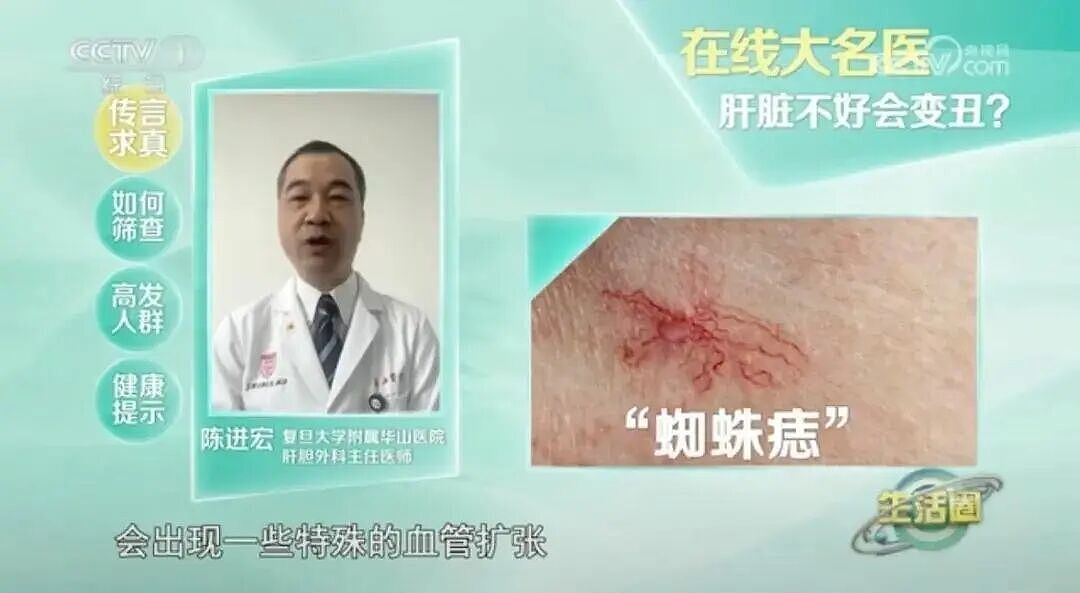 面部出现此种变化可能是恶疾前兆,24岁清秀女子样貌突变,“不爱喝奶茶也没遗传史“(组图) - 4