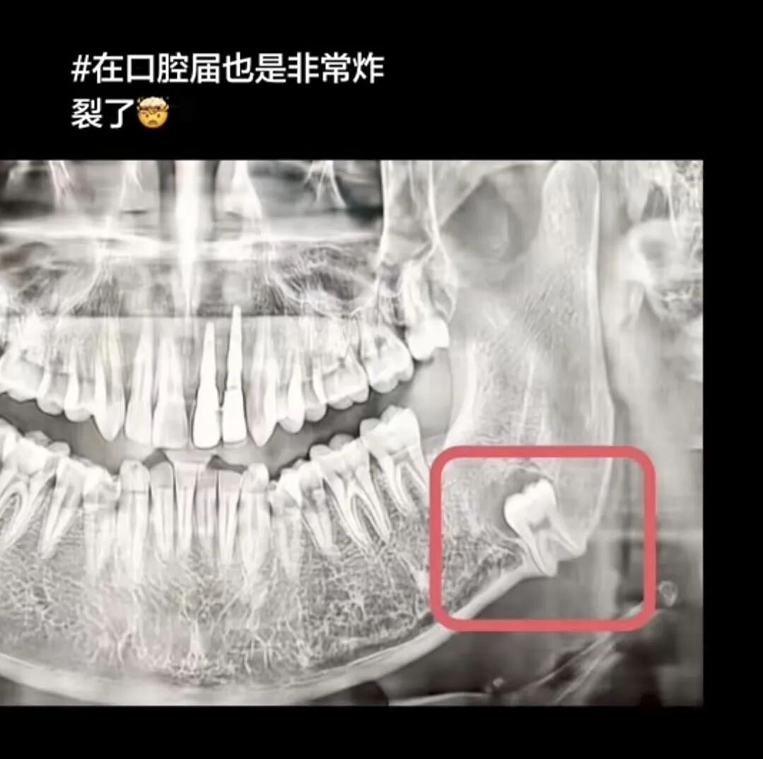 【爆笑】“冬天能把人逼疯到什么程度？”哈哈哈哈哈哈哈哈哈哈这届网友别太牛（组图） - 38