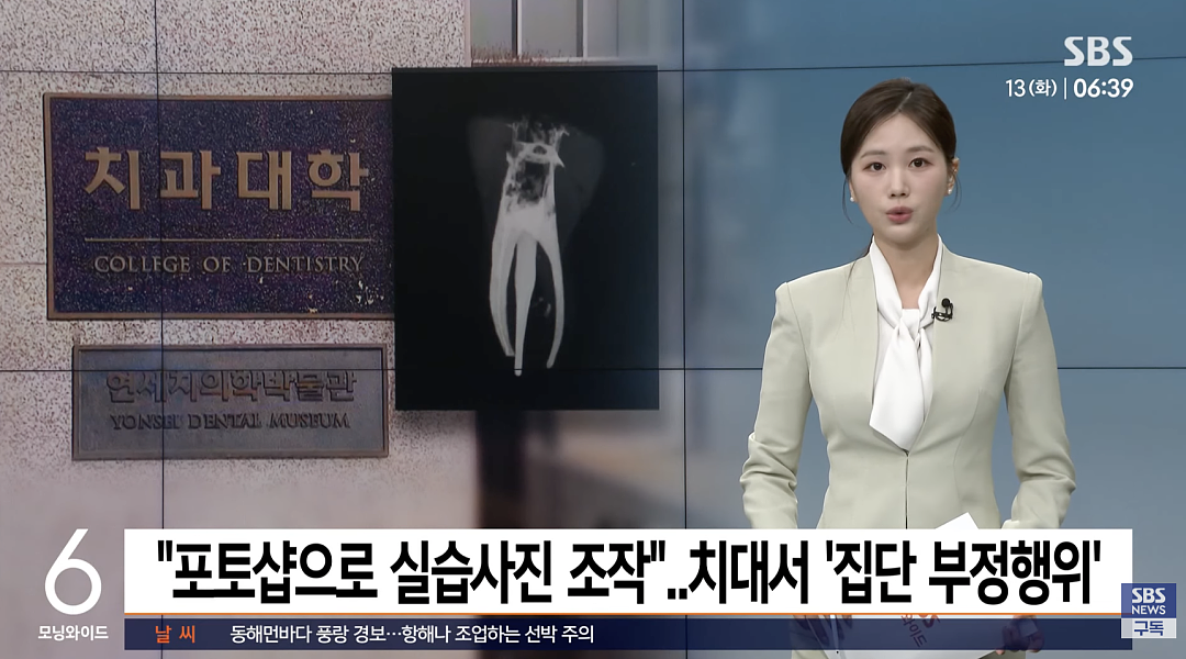 韩国顶尖大学医学生作弊，用PS修X光？牙齿根管做坏了直接P成好的，网友炸了...（组图） - 2