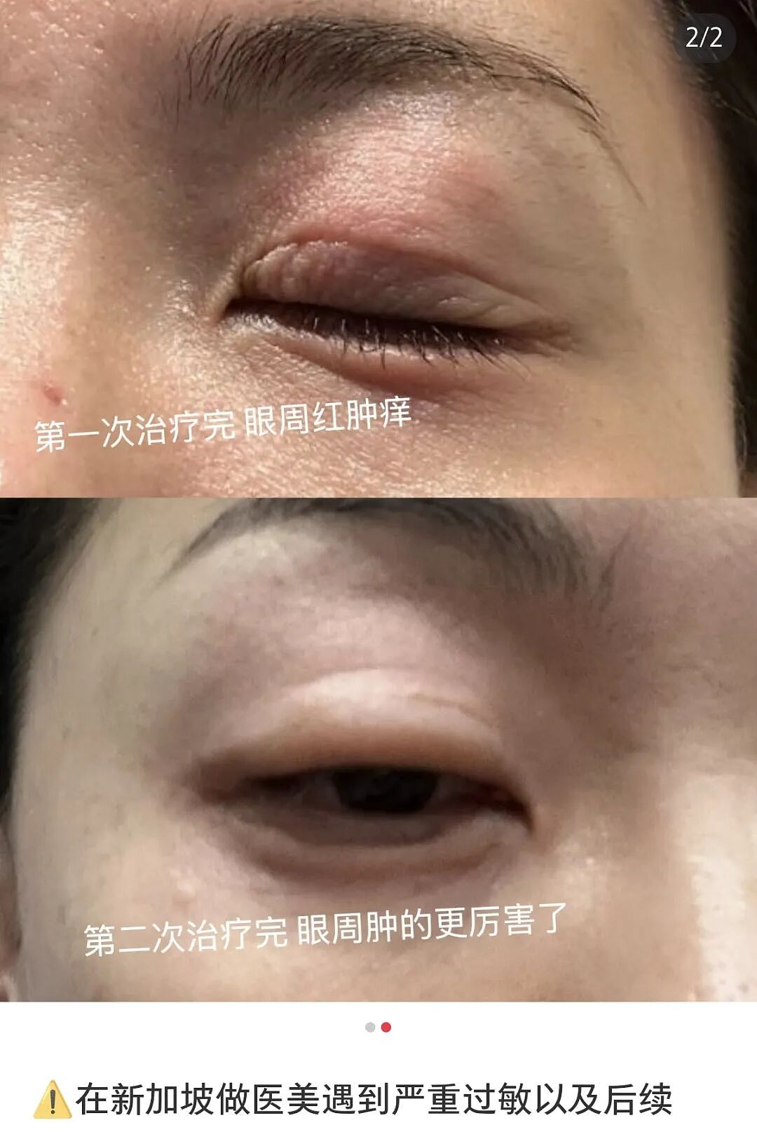 中国姑娘在新加坡公寓打“美容针”后，心脏衰竭身亡（组图） - 17
