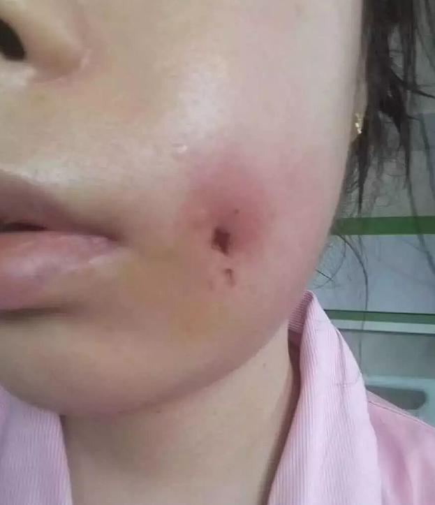 中国姑娘在新加坡公寓打“美容针”后，心脏衰竭身亡（组图） - 18