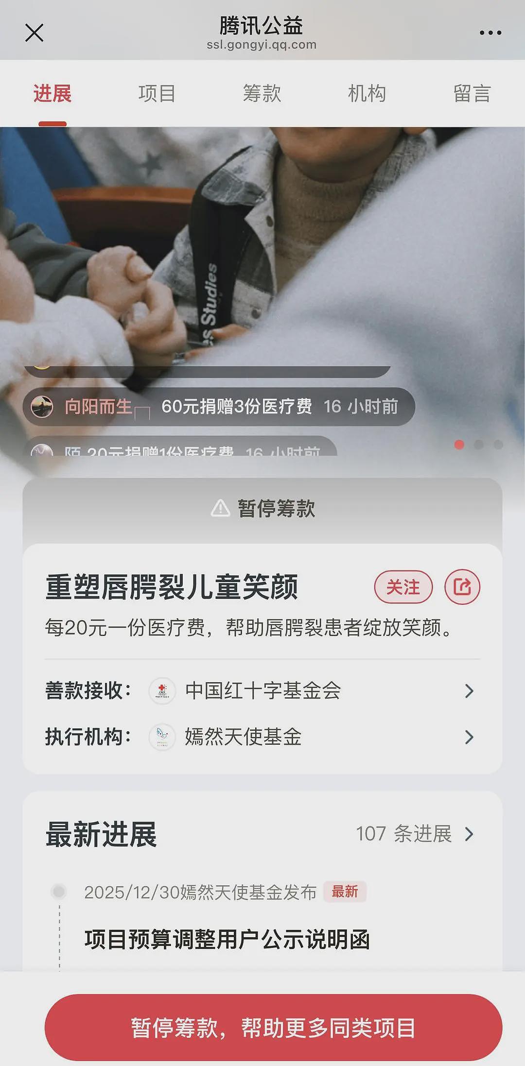 嫣然天使基金暂停筹款，工作人员：大量网友捐款，常规筹款预算已满！此前网友已捐超1800万（组图） - 1