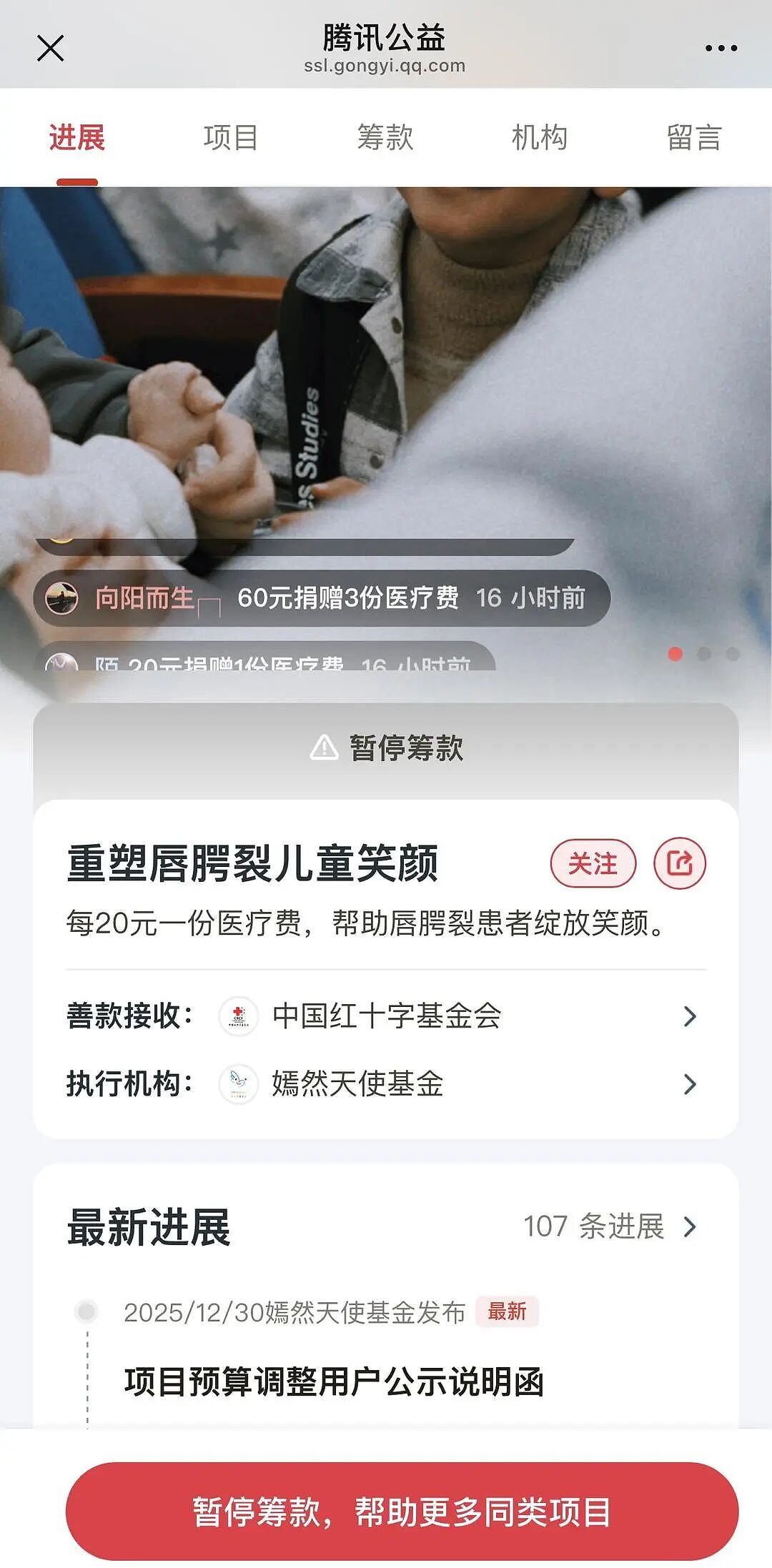 捐款已破1800万!嫣然天使基金暂停筹款,但善款依法不能用于交房租(组图) - 1