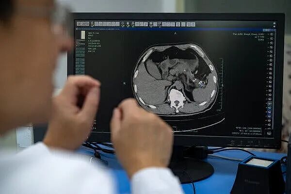 硅谷用AI写诗,中国用AI救命:纽约时报整版报道揭开中美AI背后的残酷真相(组图) - 4
