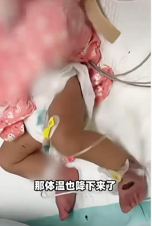 10月大男婴全身被母亲扎数百针放血，不听话就会被扎针，警方已介入（组图） - 2