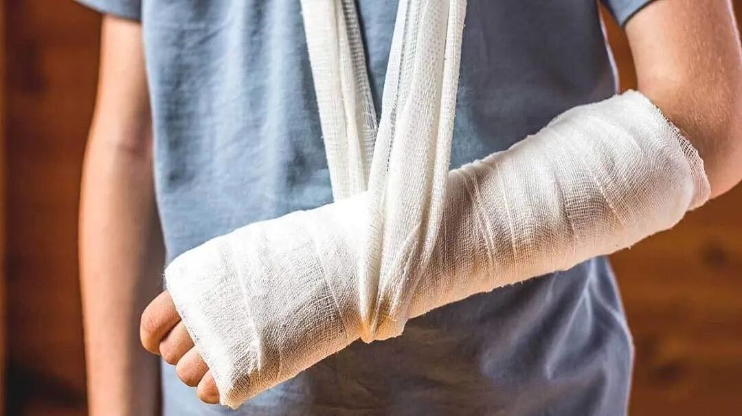 为了不让4岁女孩截肢，医生做了个疯狂的决定：把她小腿骨拆下来装在手臂上（组图） - 2