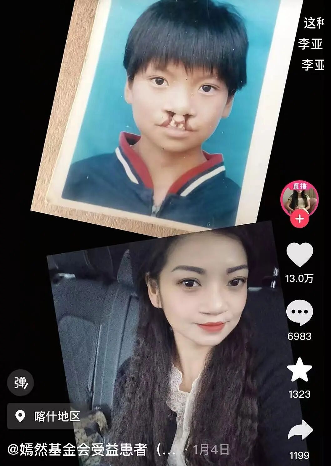 【情感】李亚鹏“哭穷”上热搜!33万人捐1857万,前妻也来点赞,背后的故事让全网破防(组图) - 11