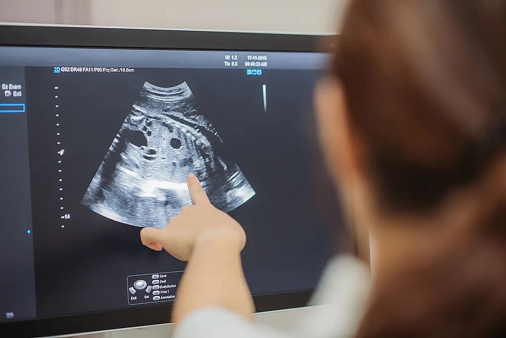 女子腹痛就医竟得知怀孕,23分钟后诞下男婴!网友惊呆:心真大…(组图) - 4
