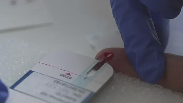 英国团队研究以指尖采血检测诊断阿兹海默症(组图) - 2