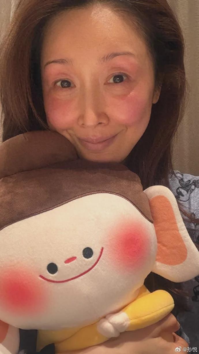 孙悦自曝:录春晚被冻伤!素颜照满脸通红,网友直呼心疼:太冷了...(图) - 1