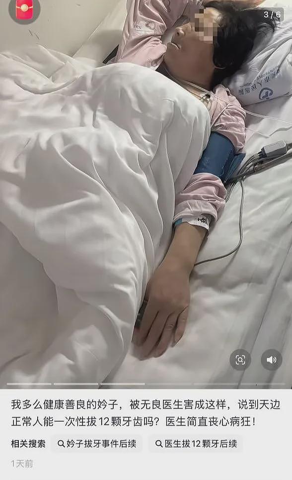 女子一次性被拔12颗牙，致心梗休克！当地卫健局通报：情况属实（组图） - 2
