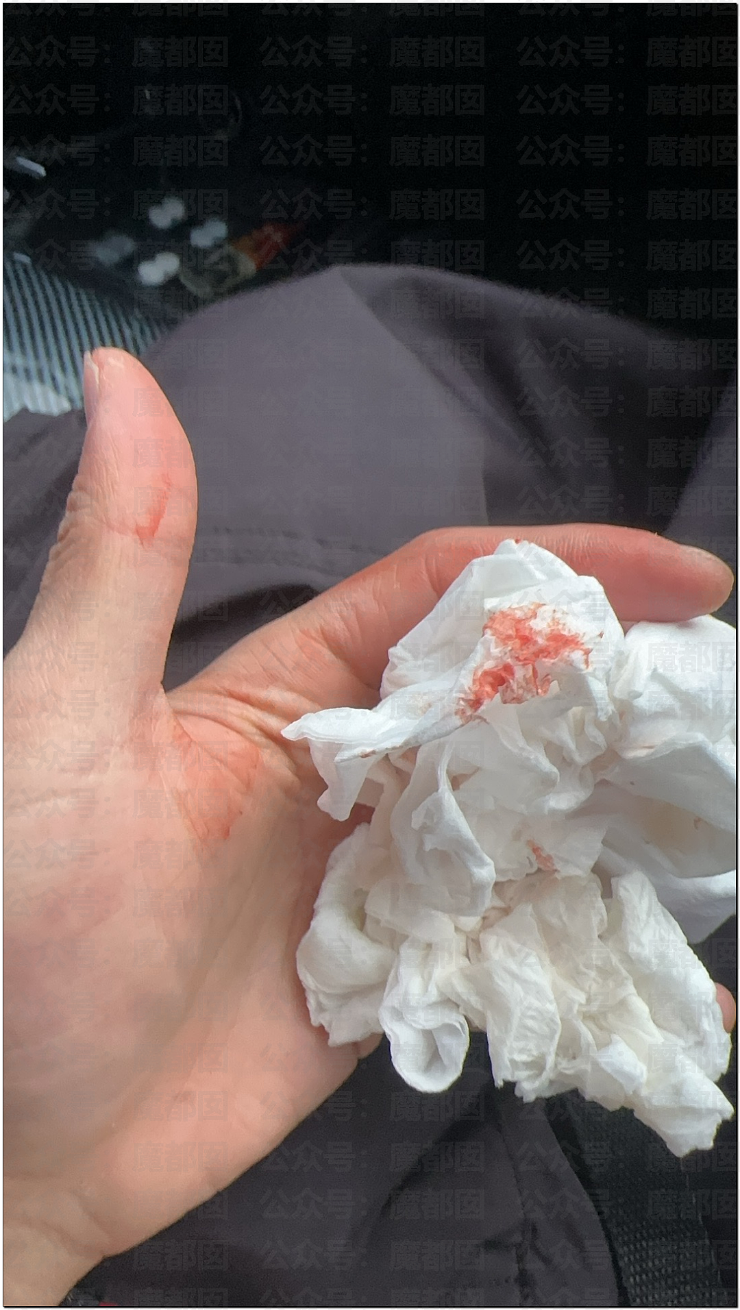 震撼！漂亮女生新疆旅游被野生雪豹撕咬，血流满面被人搀扶走出险境（视频/组图） - 7