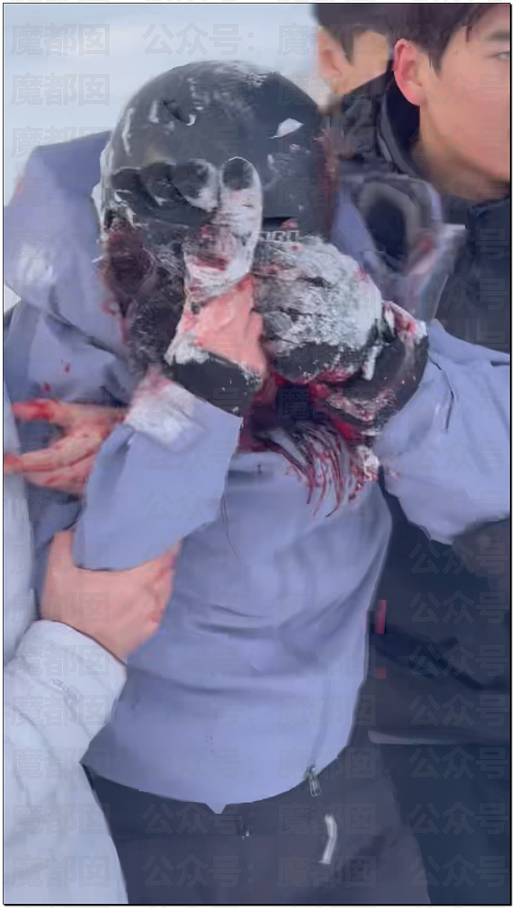 震撼！漂亮女生新疆旅游被野生雪豹撕咬，血流满面被人搀扶走出险境（视频/组图） - 10