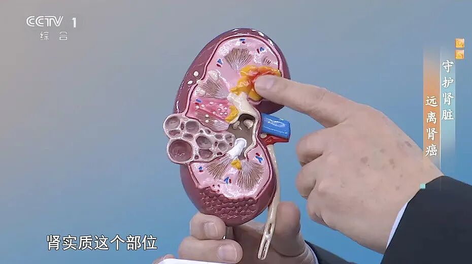 喝水出现这5异常，有1个就需警惕，可能是身体发出的求救信号！小心癌症找上门（组图） - 3