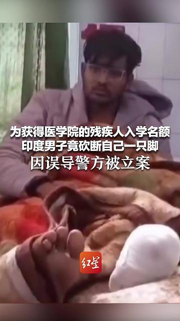 为获医学院残疾人入学名额，印度男子竟砍断自己脚（图） - 1