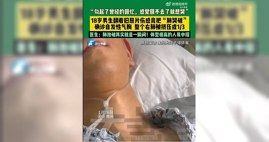 河南男大生半夜翻照片太伤感，情绪激动竟哭破肺，右肺塌陷剩1/3（图） - 1