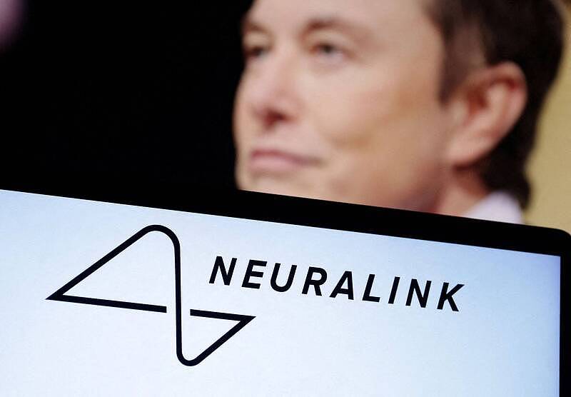 再秀黑科技！马斯克宣布：脑机公司Neuralink准备好让盲人重见光明（组图） - 1