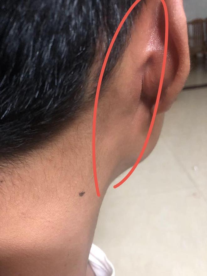 网友称吃一款药后疯狂买彩票，医生：确实可能引起病理性赌博，但概率较低（组图） - 6