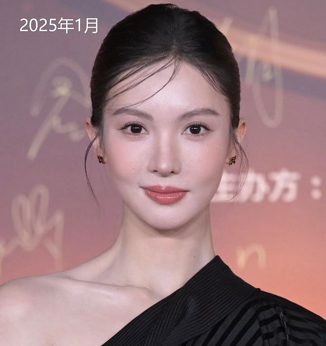 金晨被曝逃逸原因是撞伤鼻子，紧急回医院修复，前后对比照曝光（组图） - 17