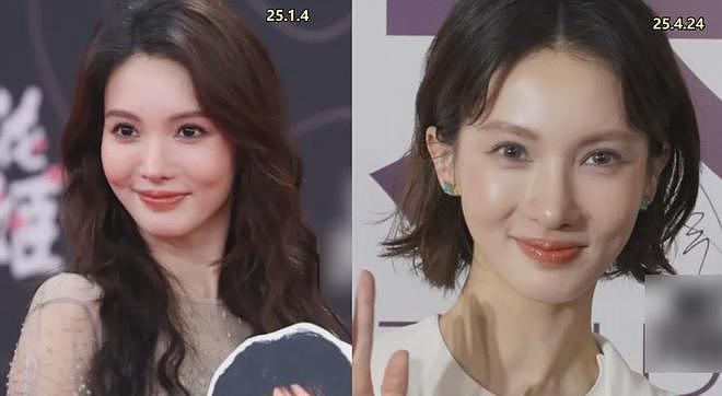 金晨被曝逃逸原因是撞伤鼻子，紧急回医院修复，前后对比照曝光（组图） - 16