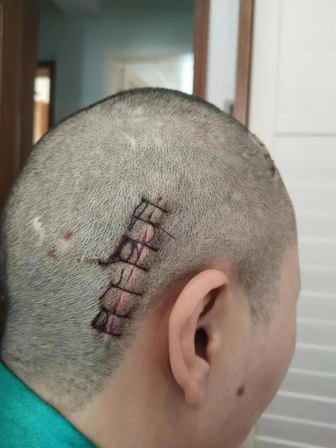 网友称吃一款药后疯狂买彩票，医生：确实可能引起病理性赌博，但概率较低（组图） - 5