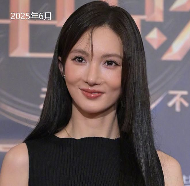金晨被曝逃逸原因是撞伤鼻子，紧急回医院修复，前后对比照曝光（组图） - 18