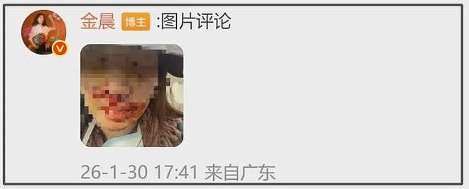 金晨被质疑下水军洗白,甩锅式公关翻车,网友吐槽她把助理当死士(组图) - 3