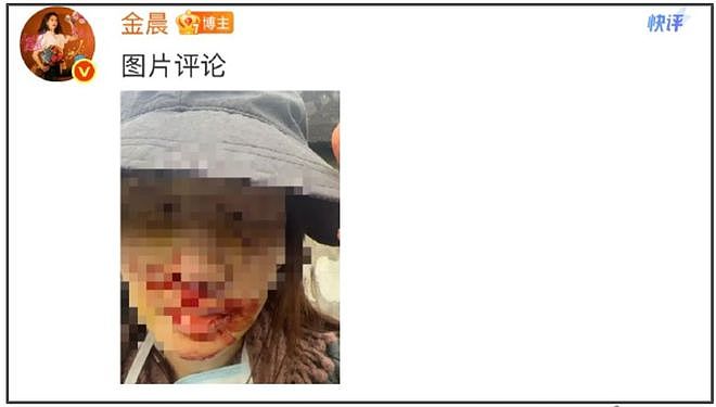 金晨度过危机?品牌方公开私密微博力挺,网友持续抵制要求处罚(组图) - 6