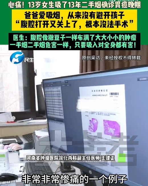 13岁女孩确诊胃癌晚期，爸爸常年吸烟从不避开孩子，医生：腹腔布满肿瘤，没有任何治愈机会（组图） - 1