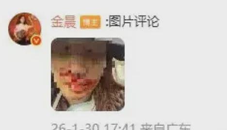 金晨事件的通报里,有三句话很值得商榷!(组图) - 3