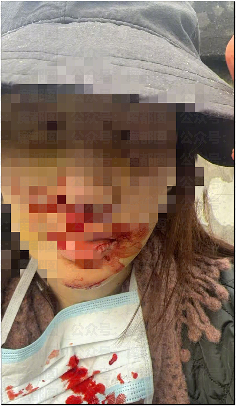 金晨交通肇事最终通报！却引发网友大面积质疑？是否应该担责？（组图） - 7
