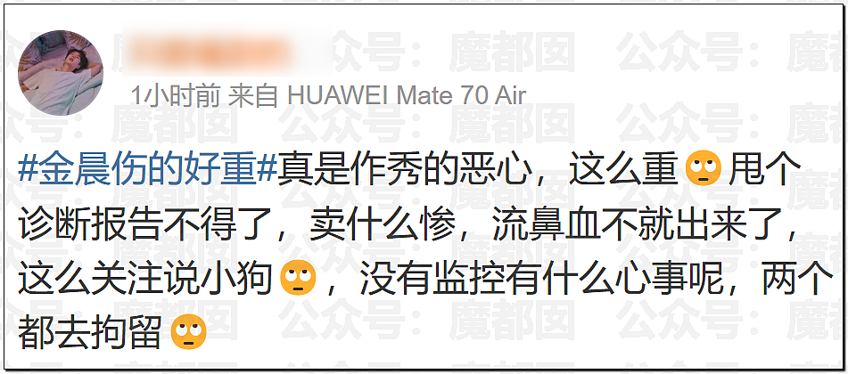 金晨交通肇事最终通报！却引发网友大面积质疑？是否应该担责？（组图） - 13