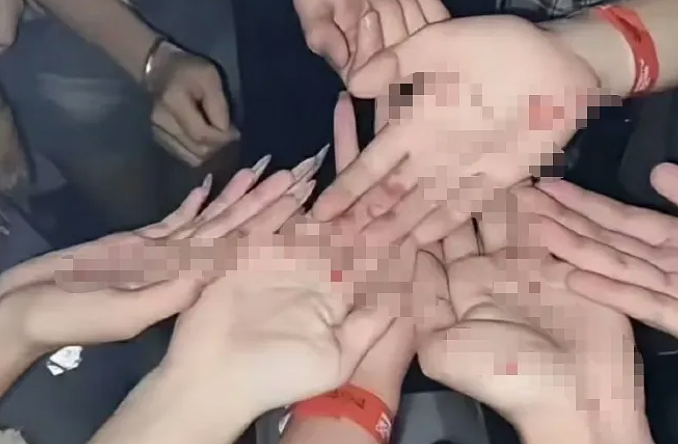 “美国斩杀线”事件后牢A继续喷日本：这些街头秀“梅毒”斑的少女真吓人（组图） - 9