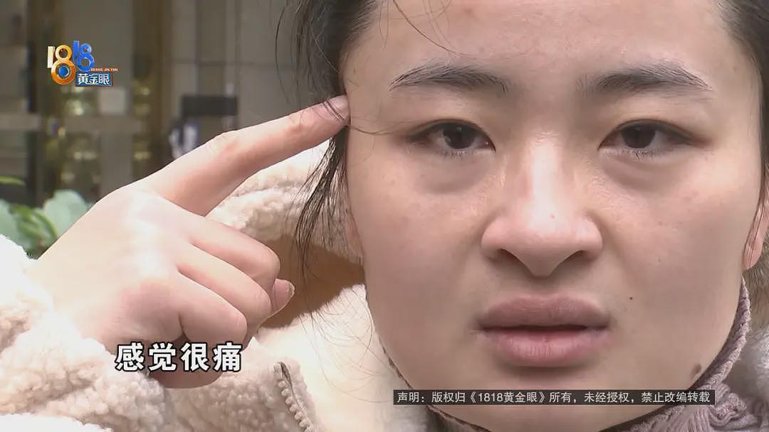 一口气做了5个项目，她觉得不像之前的脸了（视频/组图） - 7