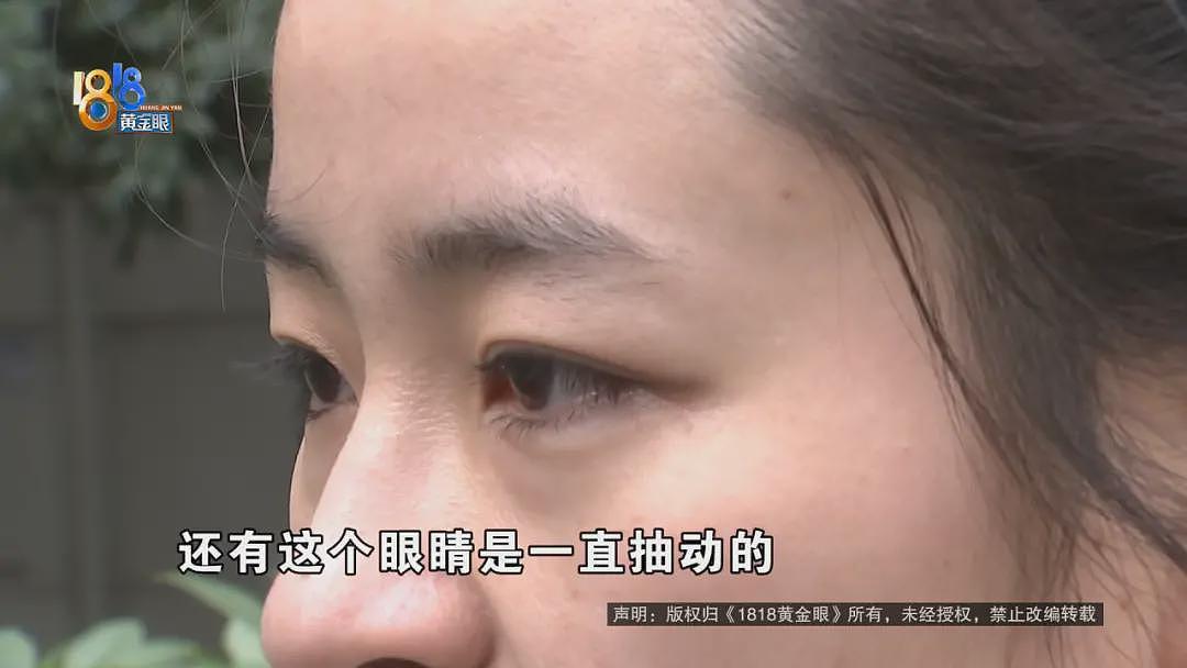 一口气做了5个项目，她觉得不像之前的脸了（视频/组图） - 9