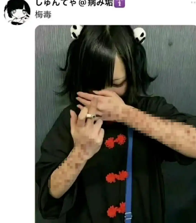 “美国斩杀线”事件后牢A继续喷日本：这些街头秀“梅毒”斑的少女真吓人（组图） - 15