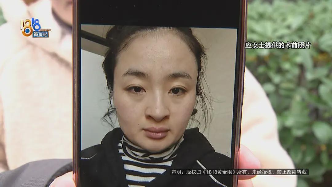 一口气做了5个项目，她觉得不像之前的脸了（视频/组图） - 8