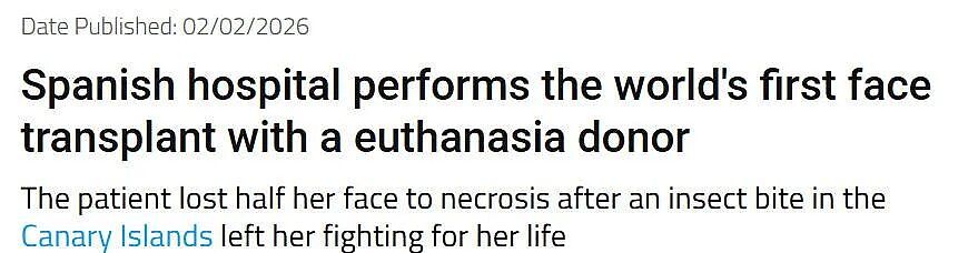 真·换脸!妹子接受死者捐赠,把别人脸换自己头上,效果...居然还行?(组图) - 1