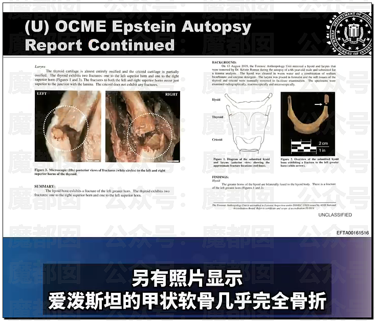 外网吵翻！爱泼斯坦最新自杀照片公布！诸多疑点？竟然没死（视频/组图） - 9