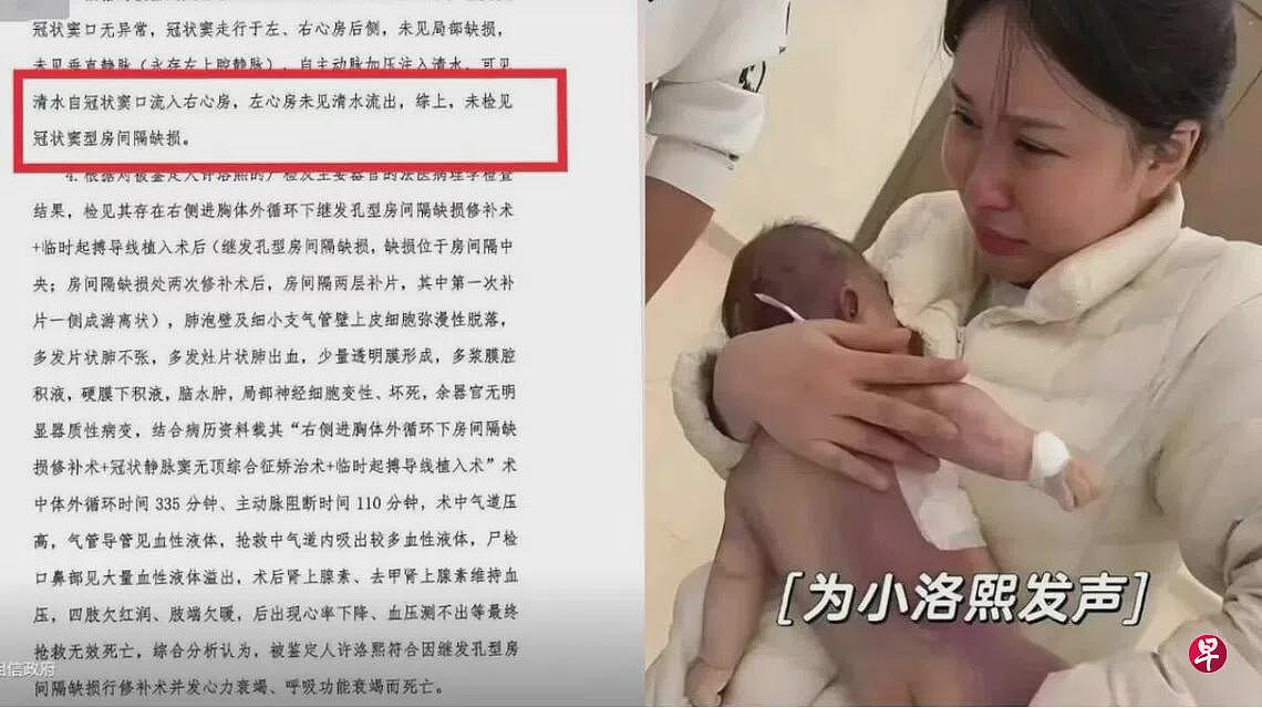 小洛熙事件调查结果出炉：一级甲等医疗事故，院长被免职（图） - 1