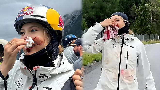 谷爱凌脑出血险丧命!休克5分钟伴癫痫,母亲哭诉:差点醒不来(组图) - 16
