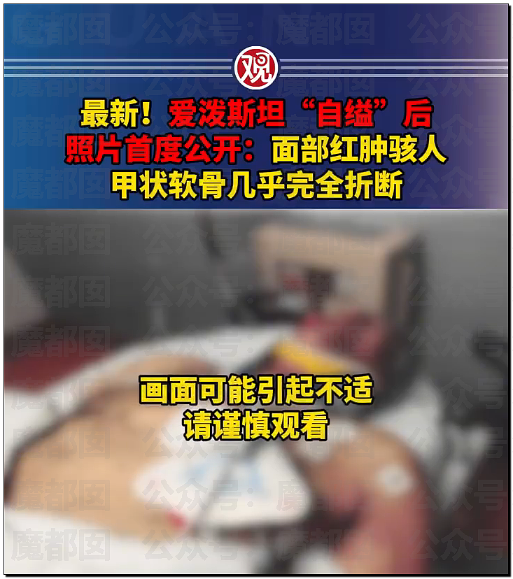 外网吵翻！爱泼斯坦最新自杀照片公布！诸多疑点？竟然没死（视频/组图） - 3